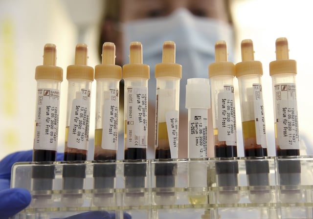 Serum tubes with blood samples from patients are processed in the central medical laboratory of the St. Georg Clinic in Leipzig.