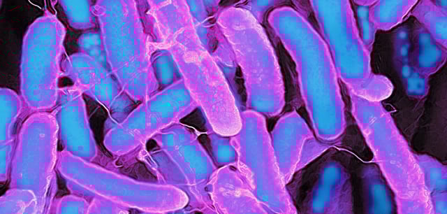 Die Bakterien Escherichia coli unter dem Elektronenmikroskop