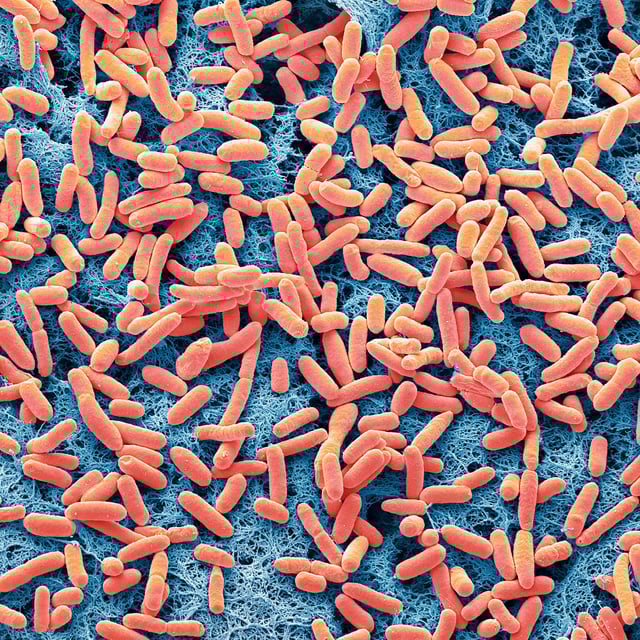 Escherichia coli: Die Bakterien können PET zersetzen und daraus Paracetamol herstellen.