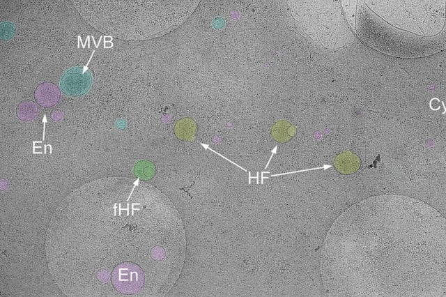 Pictured: the newly discovered organelle, the hemifusome, in yellow