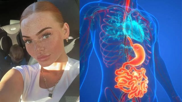 Woman Diagnosed With Stage 4 Stomach Cancer After Doctors Misdiagnosed Her Symptoms, Giving Meds For Acid Reflux