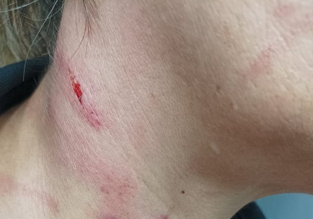 Imagen de la trabajadora de la cárcel de Picassent, brutalmente agredida por una reclusa
