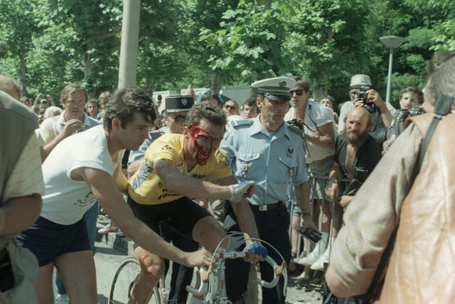 Bernard Hinault en sang après avoir chuté dans les derniers hectomètres de la 14e étape du Tour de France le 13 juillet 1985 à Saint-Etienne, l'image symbole de son cinquième et dernier succès sur la Grande boucle