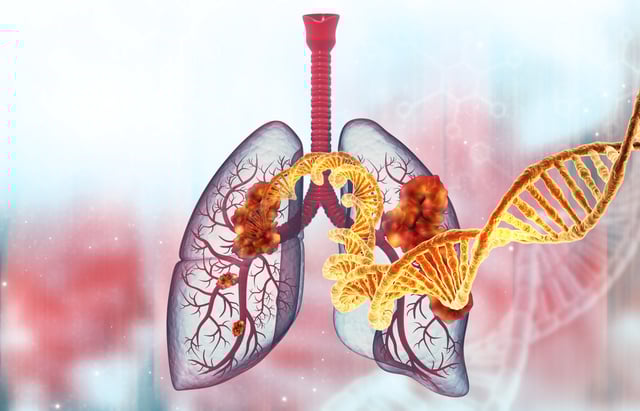 An artist&#39;s impression of lung cancer and DNA.