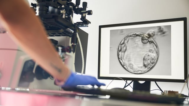 An embryologist works with advanced imaging equipment while an embryo appears on the computer screen, symbolizing the high-precision fertility techniques used in the STAR system—an AI-powered method that helped detect hidden sperm in azoospermic men, leading to successful pregnancies after years of infertility.
