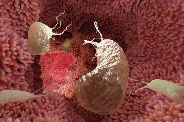 Millions of today's youth are expected to develop stomach cancer