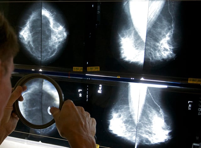 Las mujeres deben hacerse mamografías periódicas