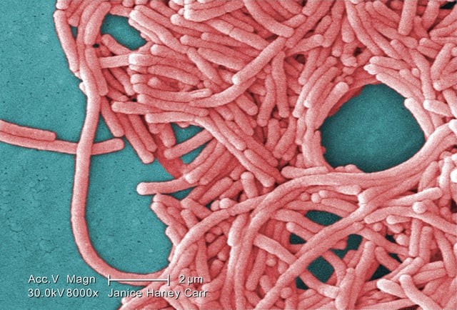 This 2009 colorized 8000X electron micrograph image provided by the U.S. Centers for Disease Control and Prevention shows a large grouping of gram-negative Legionella pneumophila bacteria. THE CANADIAN PRESS/AP-Janice Haney Carr