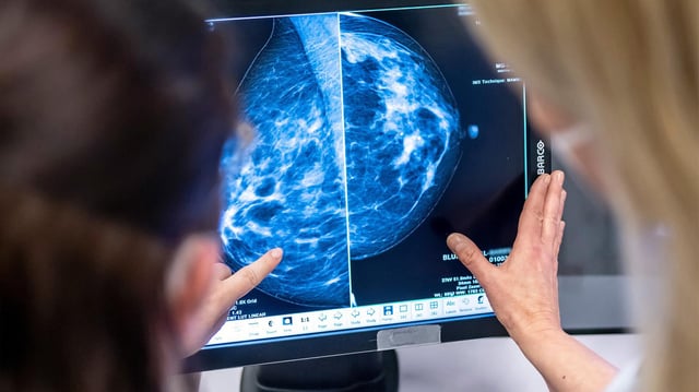 Ein Computerbildschirm mit einer Mammographie-Aufnahme