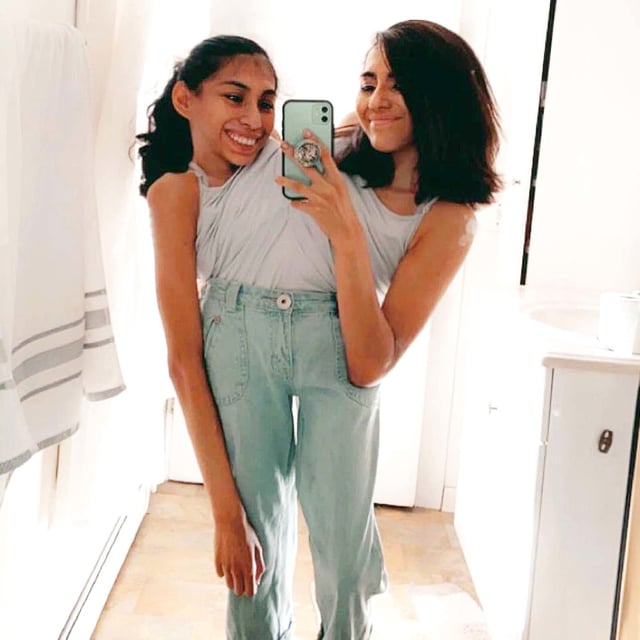 Carmen and Lupita Andrade are connected at the torso and share a pelvis and reproductive system. They each have two arms, but only one leg.