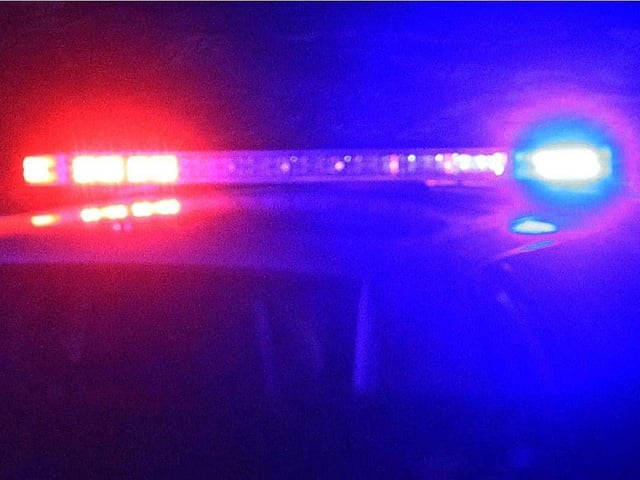Police are investigating after a woman was left with severe burn injuries in what's being called a targeted assault.