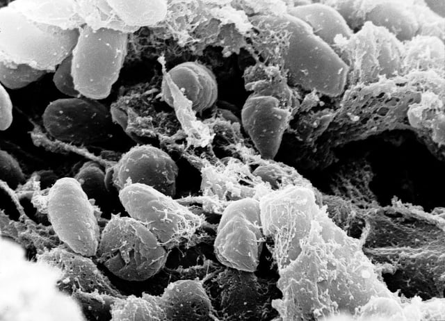 Yersinia pestis, the bacteria that causes the plague