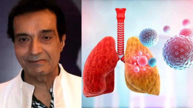 Dhiraj Kumar Death, What Triggers Acute Pneumonia Know Its Early Signs and Symptoms