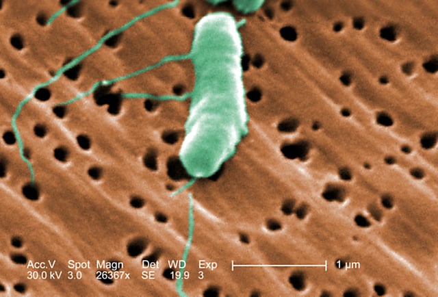 Flagellated Vibrio vulnificus bacterium revealed in the 26367x magnified scanning electron microscopic (SEM) image, 2005. Image courtesy Centers for Disease Control (CDC) / Janice Haney Carr.