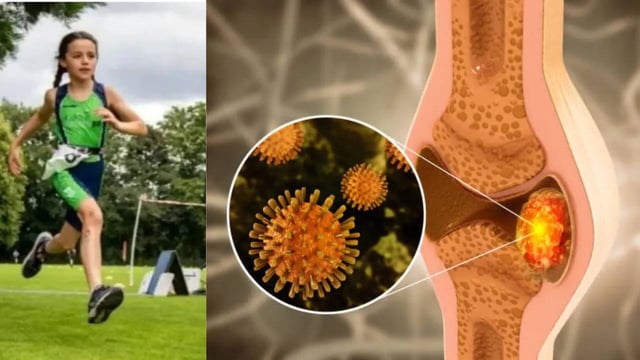 Young Girl's 'Growing Pains’ Were the First Sign of Horrifying Diagnosis of a Rare Bone Cancer