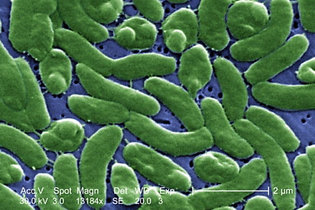 A grouping of Vibrio vulnificus bacteria revealed in the 13184x magnified scanning electron microscopic (SEM) image, 2005, image courtesy Centers for Disease Control (CDC) and colorized by James Gathany.