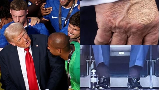 Donald Trump was spotted with 'swollen ankles and bruised hands' at the FIFA Club World Cup. (Reuters and X/ The Maine Wonk)