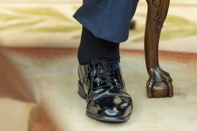 The left foot and swollen of President Donald Trump are pictured as he sits with Bahrain's Crown Prince Salman bin Hamad Al Khalifa in the Oval Office of the White House, Wednesday, July 16, 2025, in Washington. (AP Photo/Alex Brandon)