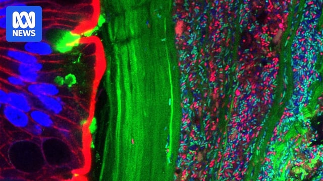 Microscope image showing tiny red and green specks of genetically modified bacteria against larger blue mammalian cells.