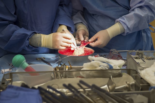FILE - Surgeons work on a kidney during a transplant surgical procedure in Washington on June 28, 2016. (AP Photo/Molly Riley, File)