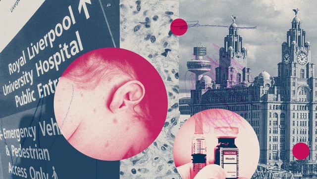 Merseyside is particularly vulnerable to a measles outbreak because so many children are unvaccinated