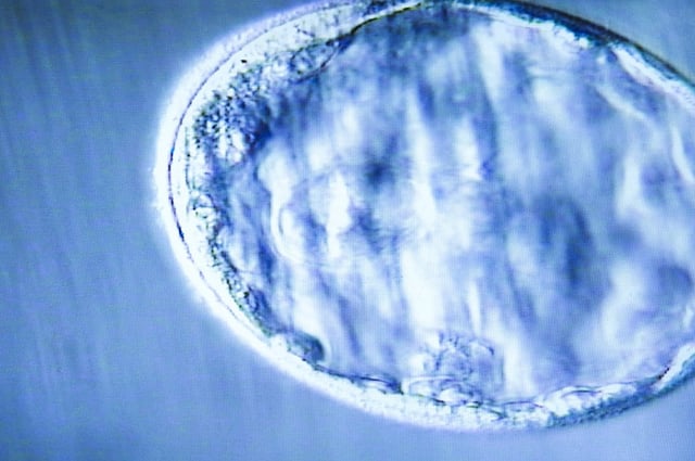 Si bien estos nacimientos son los primeros realizados bajo un protocolo clínico aprobado en el Reino Unido, no son los primeros casos del mundo.