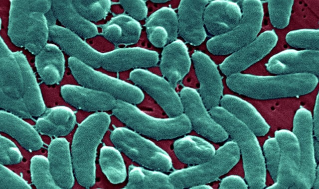Vibrio Vulnificus bacteria.