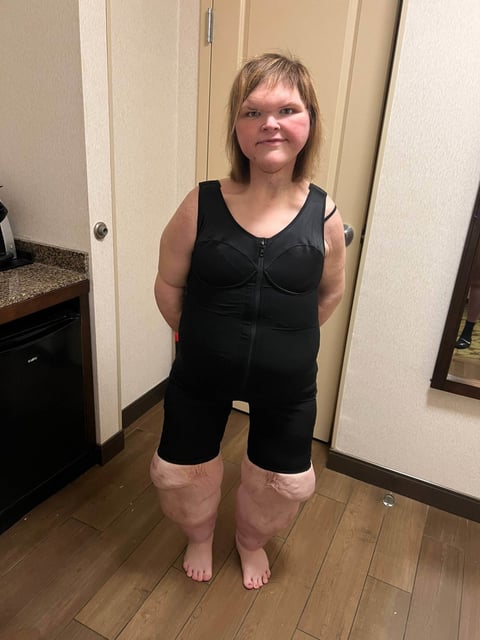 Tammy Slaton experimented with shapewear after undergoing skin removal surgery.