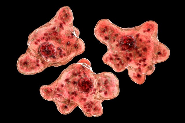 The person in South Carolina contracted the infection from he Naegleria fowleri amoeba, commonly known as a brain-eating amoeba, after swimming in Lake Murray outside of Columbia, the state capital, according to the state Department of Public Health. (GETTY IMAGES/FILE)