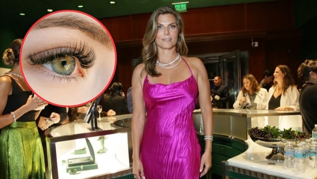 Montserrat Oliver revela que perdió parcialmente la vista por un infarto ocular ¿Qué es esta condición?