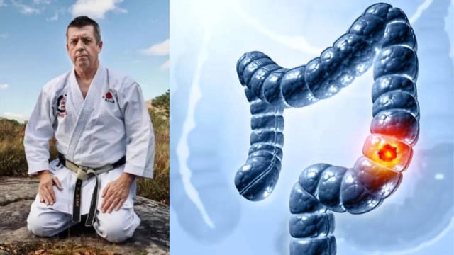 Healthy Man, Told by Doctors He Had Irritable Bowel Syndrome, Finally Gets Diagnosed with Stage 4 Cancer After His Symptoms Flare Up