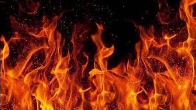 Subrata, a retired railway employee, sustained severe burn injuries and is currently undergoing treatment at the GMCH. (Representative photo)