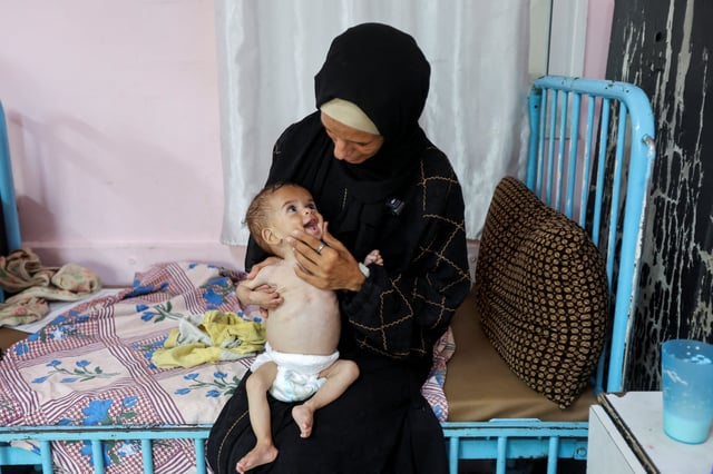 Seela Barbakh, una niña palestina de 11 meses desnutrida, según los médicos, es sostenida por su madre, Najah, en el Hospital Nasser de Jan Yunis, en el sur de la Franja de Gaza. 23 de julio de 2025. REUTERS/Ramadan Abed