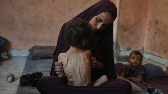 Naima Abu Ful, a Palestinian refugee at the Shati camp in Gaza, with her two-year-old malnourished child, Yazan.