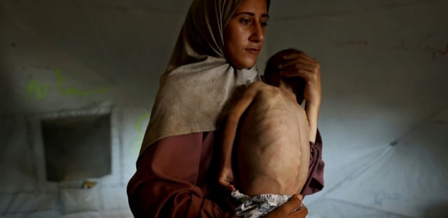 Hidaya, une mère palestinienne de 31 ans, porte son fils malade de 18 mois, Mohammed al-Mutawaq, qui présente des signes de malnutrition, au camp de réfugiés d'Al-Shati, à l'ouest de la ville de Gaza, le 24 juillet 2025