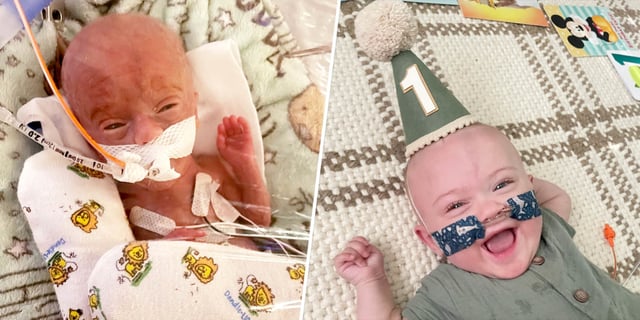 Baby Nash Keen, who was named ‘world’s most premature baby’ by Guinness World Records.