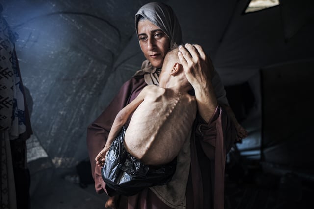 A Palestinian mother with her severely malnourished child in Gaza City on July 21, 2025. 
