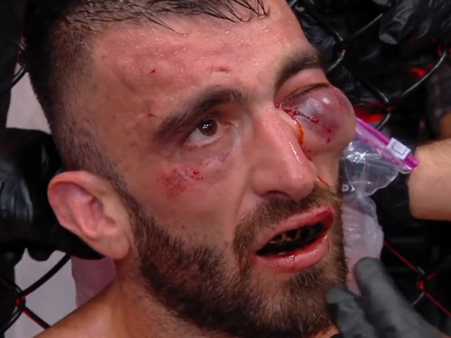 El ojo del emiratí Mohamamad Yahya, la imagen viral del fin de semana en la UFC.