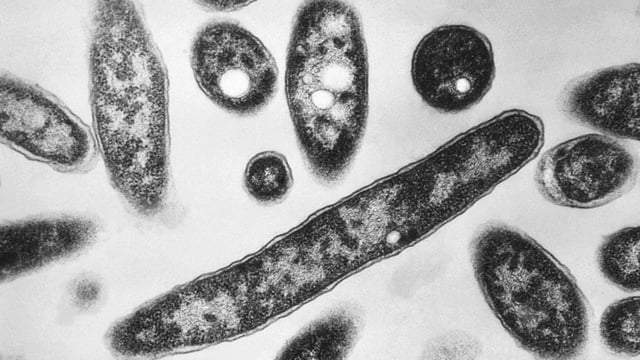 Legionnaire's disease is not transmissible, but it can be fatal if left untreated, according to the officer.