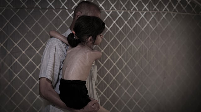 Five-year-old Lana Salih Juha, who fled with her family from Gaza&#39;s Shuja&#39;iyya neighborhood to the city center, suffers from severe malnutrition, seen on July 28, 2025.