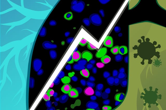 An illustration of cancer cells marked with green, and the proliferation of cells marked in magenta.