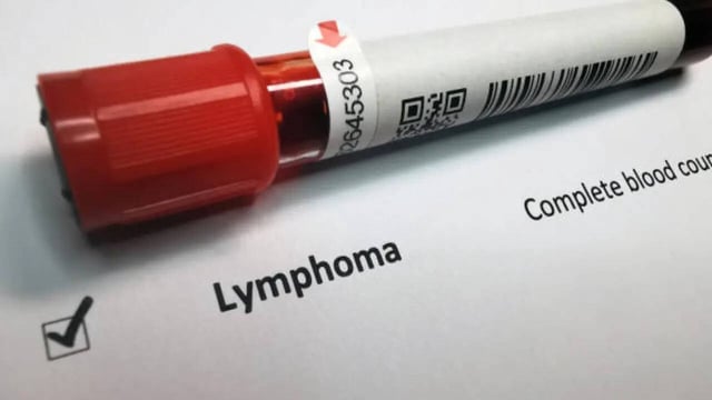 Young Anti-vaccine Campaigner Dies After Refusing Chemotherapy For Treatable Cancer