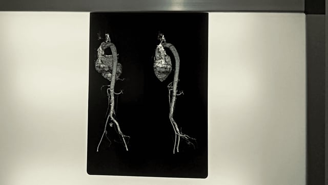 Your Organs Don’t All Age At The Same Rate. One Is Growing Old Much Quicker Than Others