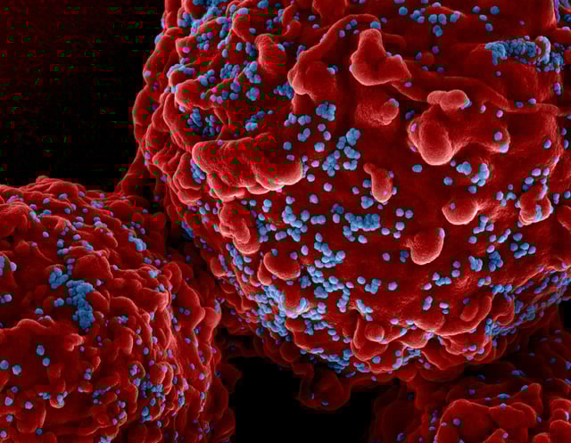Colorized scanning electron micrograph of HIV-1 virus particles (blue) both budding and attached to the surface of Hut-78/human lymphocyte cells (red). Image captured at the NIAID Integrated Research Facility in Fort Detrick, Maryland. Credit: NIAID