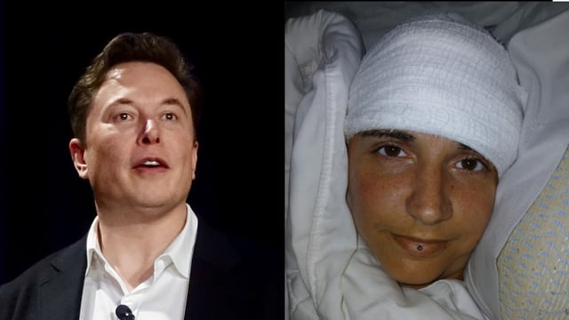 elon musk and neuralink patient