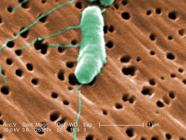Riesgos y síntomas de la bacteria carnívora que vive en el mar. Foto: Centers for Disease Control and Prevention