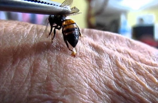 Abeja picando la mano de una persona