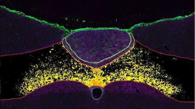 false-color microscopic image of the hindbrain shows support cells (highlighted in green, red, yellow, and purple) that naturally produce appetite-suppressing molecules. Researchers at Syracuse University are targeting these cells to develop weight loss drugs that avoid the nausea and vomiting commonly seen with GLP-1 treatments.