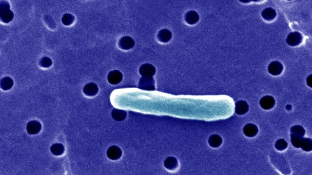 Escherichia Coli, Sem, Infection Can Also Occur After Drinking Raw Milk And After Swimming In Or Drinking Sewage-Contaminated Water. (Photo By BSIP/Universal Images Group via Getty Images)