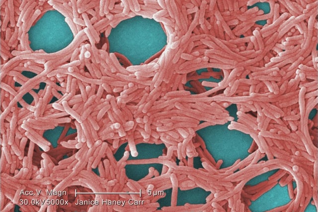 Colorized scanning electron micrograph (SEM) with moderately-high magnification of 5000X, depicting a large grouping of Gram-negative Legionella pneumophila bacteria